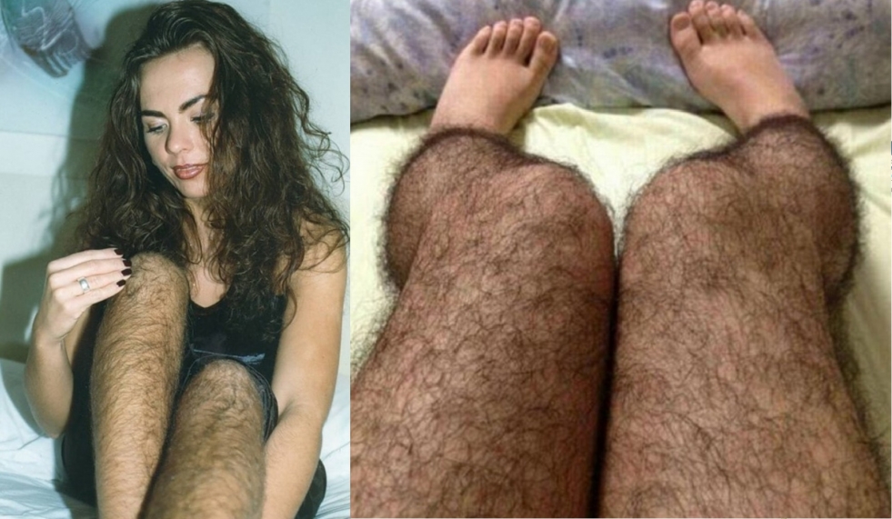 Girl with not british legs