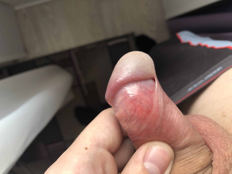 Huge dick with long extreme flesh