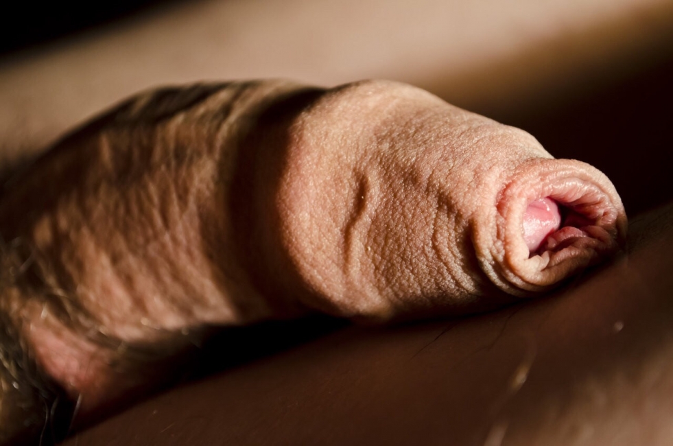 Black member with extreme flesh