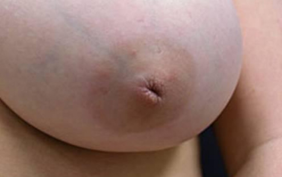 Pornstar with drawn nipples