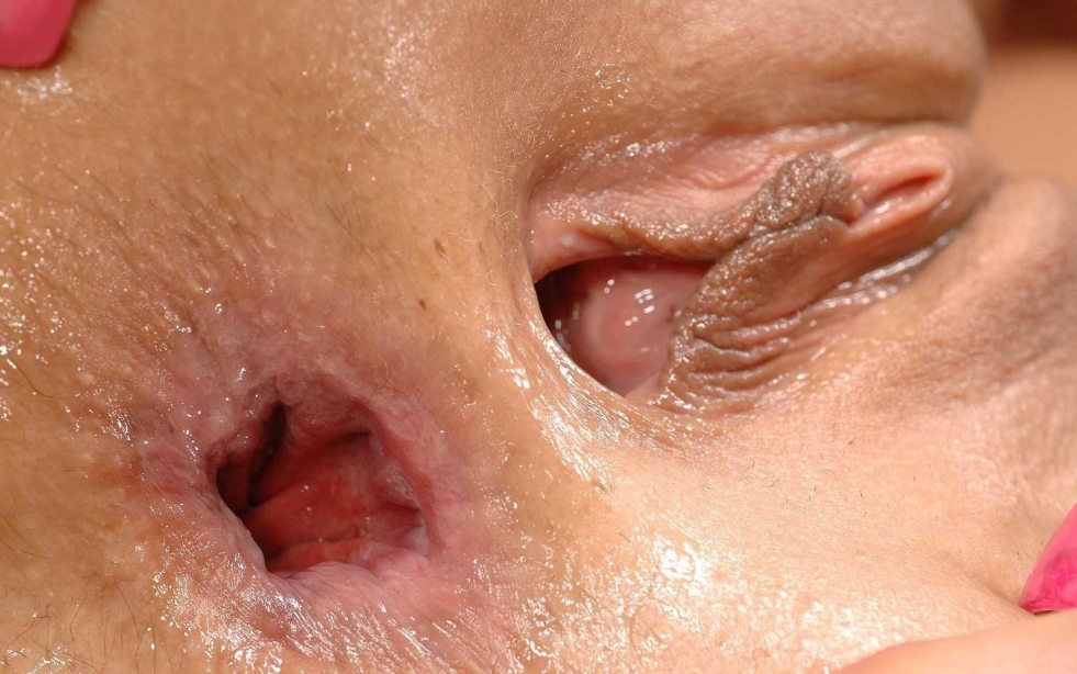 Anal hole close-up