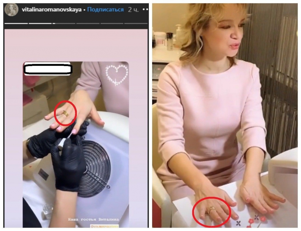 Vitalin Tsymbalyuk Romanovskaya legs