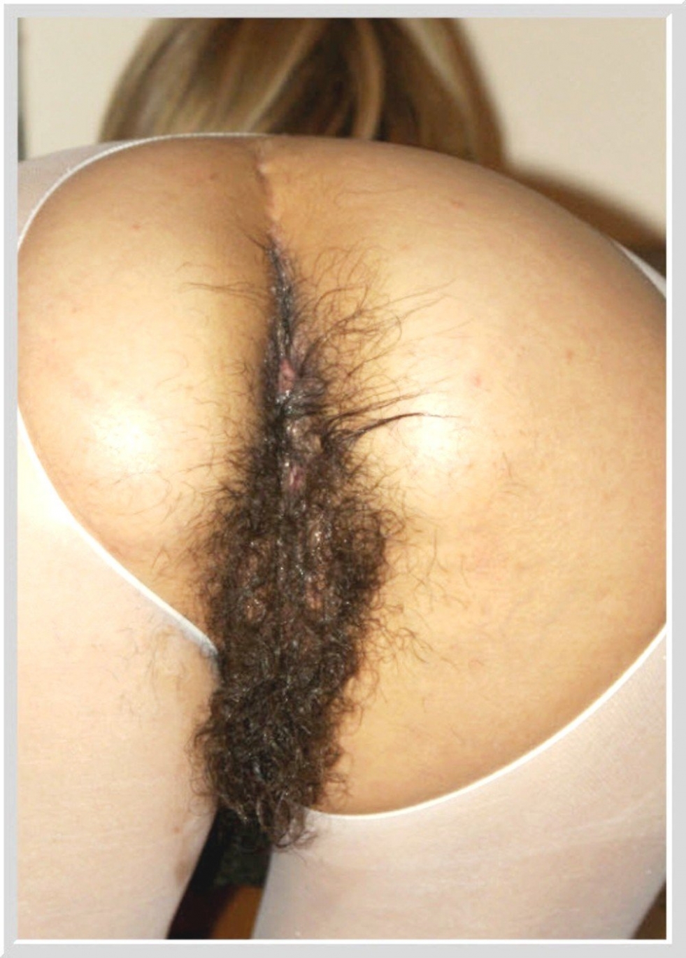 Very hairy female ass