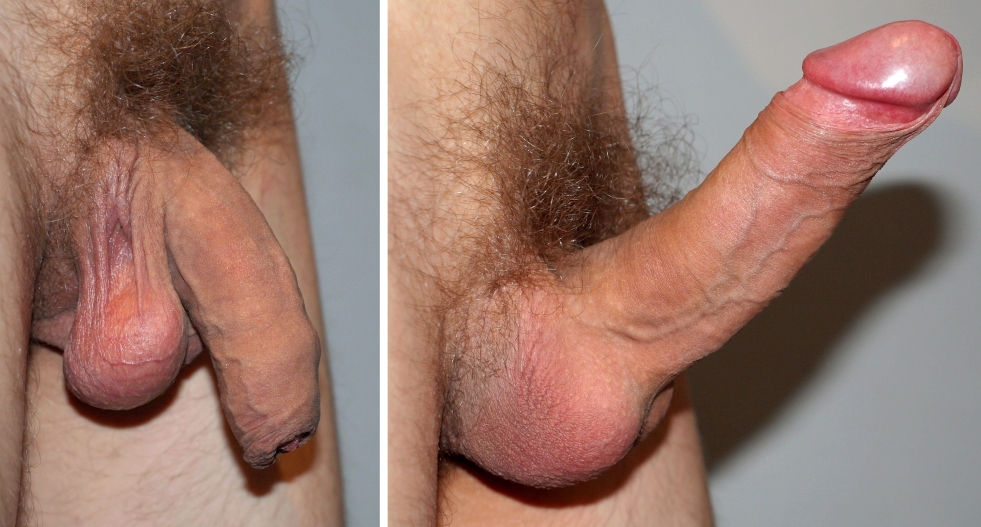 Male member close-up