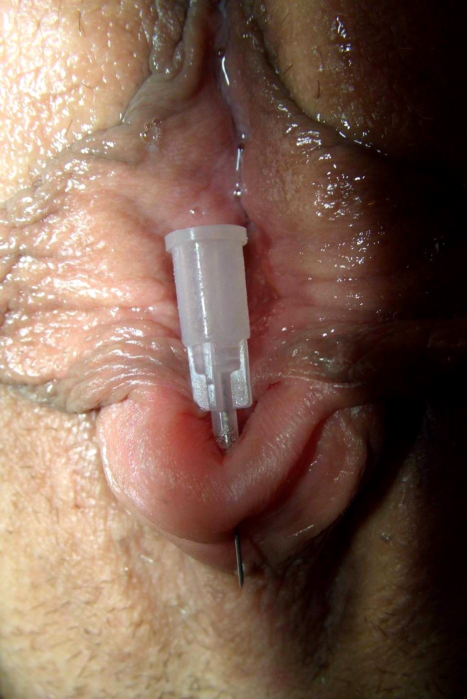 Needle in the head of the clitoris