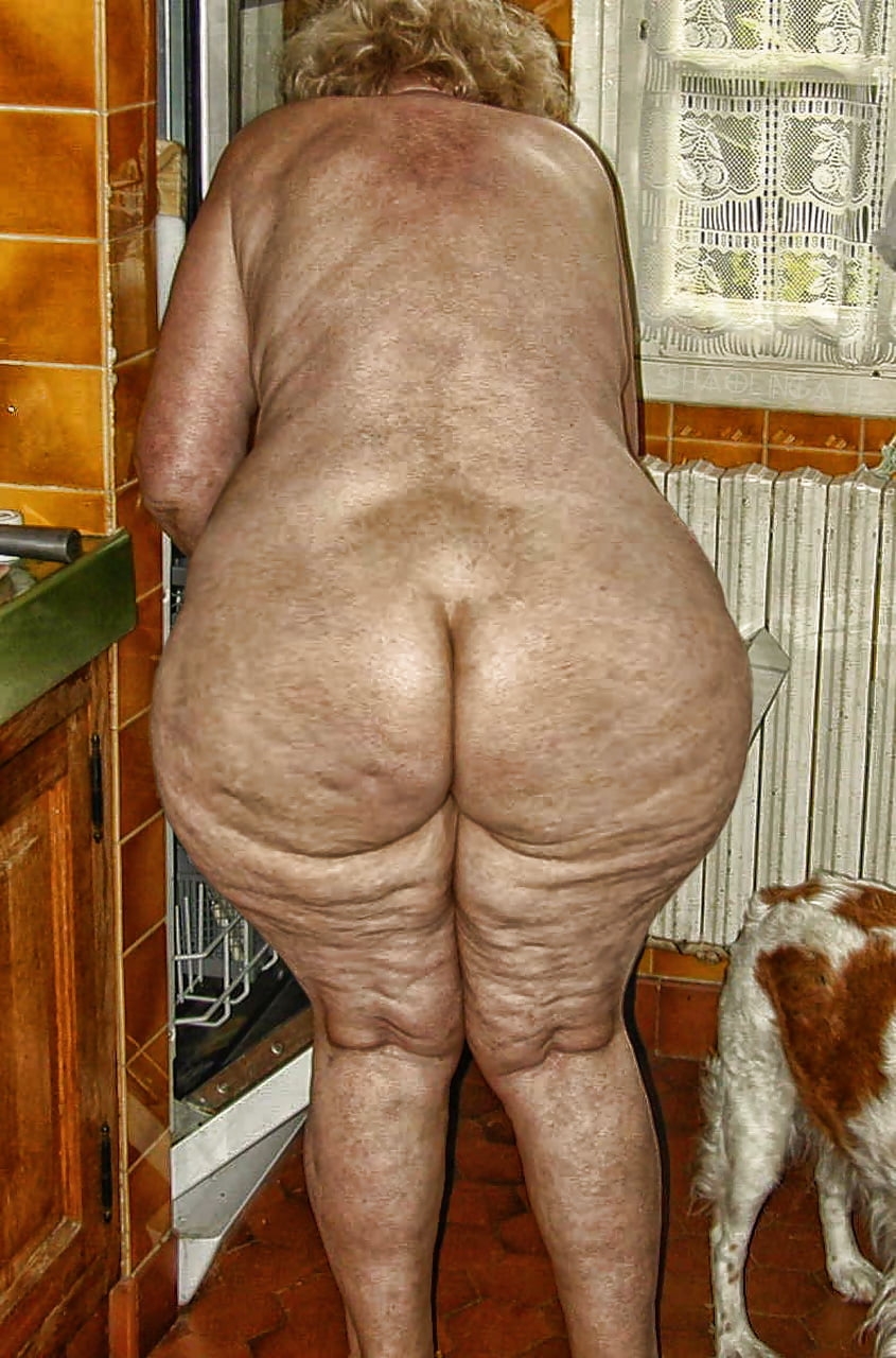 Old fat cellulite