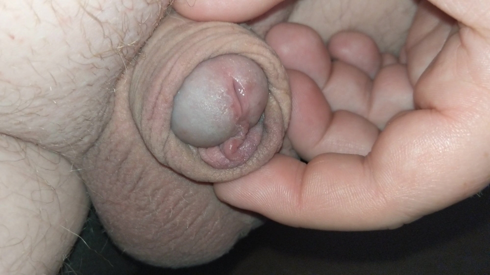 Photo Micro Penis Boy