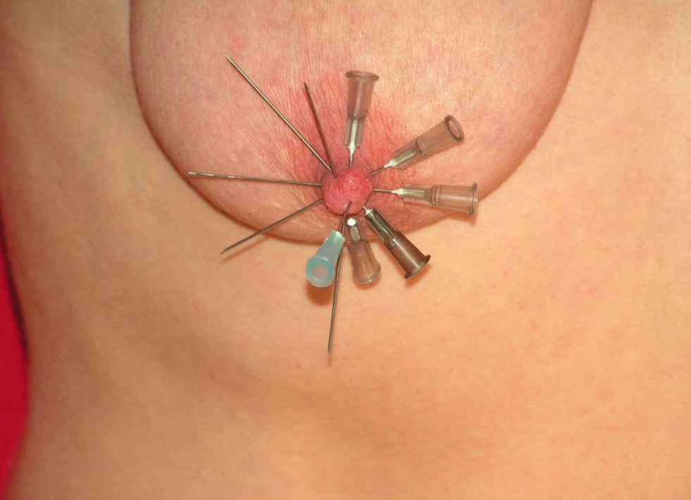 BDSM piercing needles