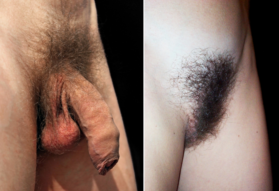 Lobber hair in men and women