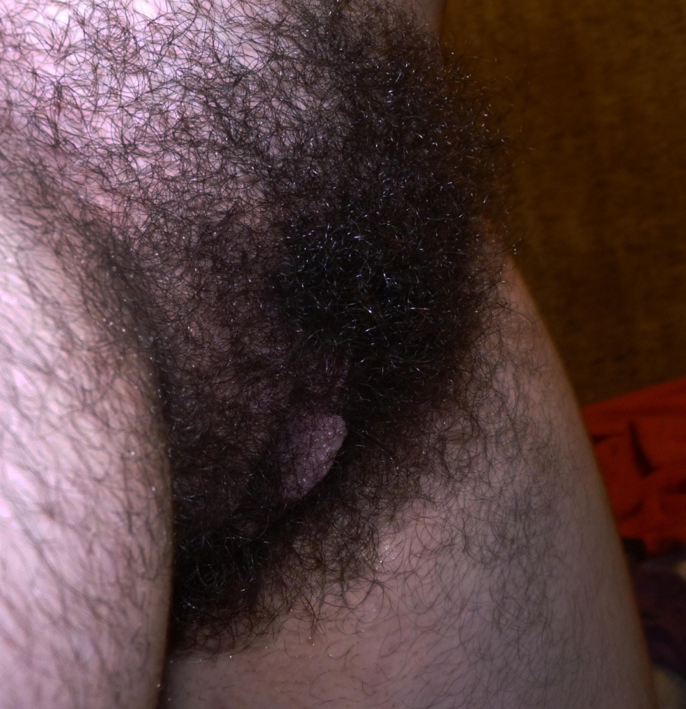 Thick black hair on the pubic