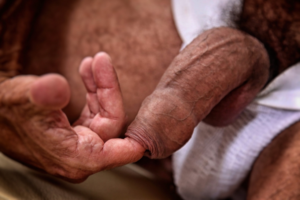 Men's penises with extreme flesh