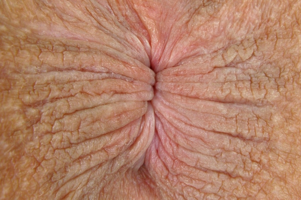 Dirty female anus close-up