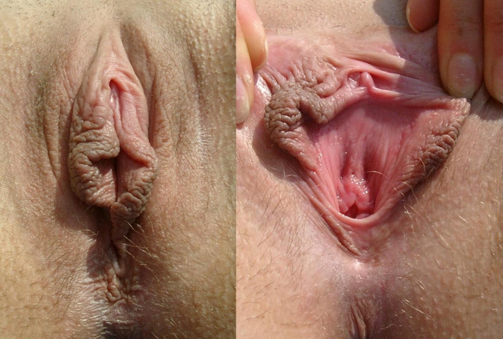 The vagina is the clitoris large
