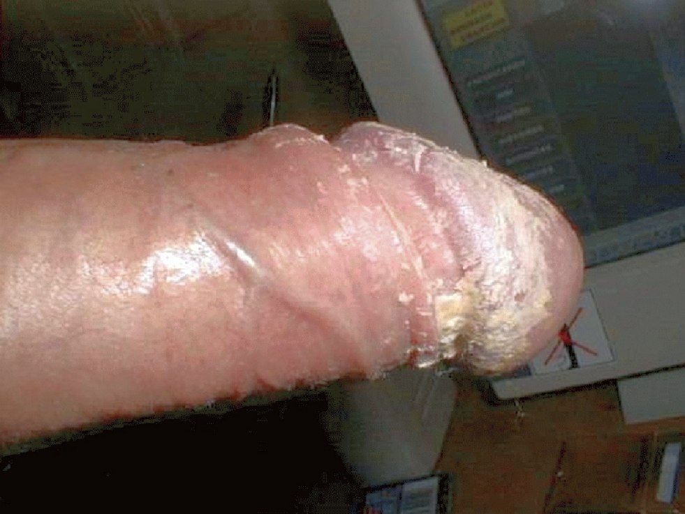 Huge dick with cottage cheese