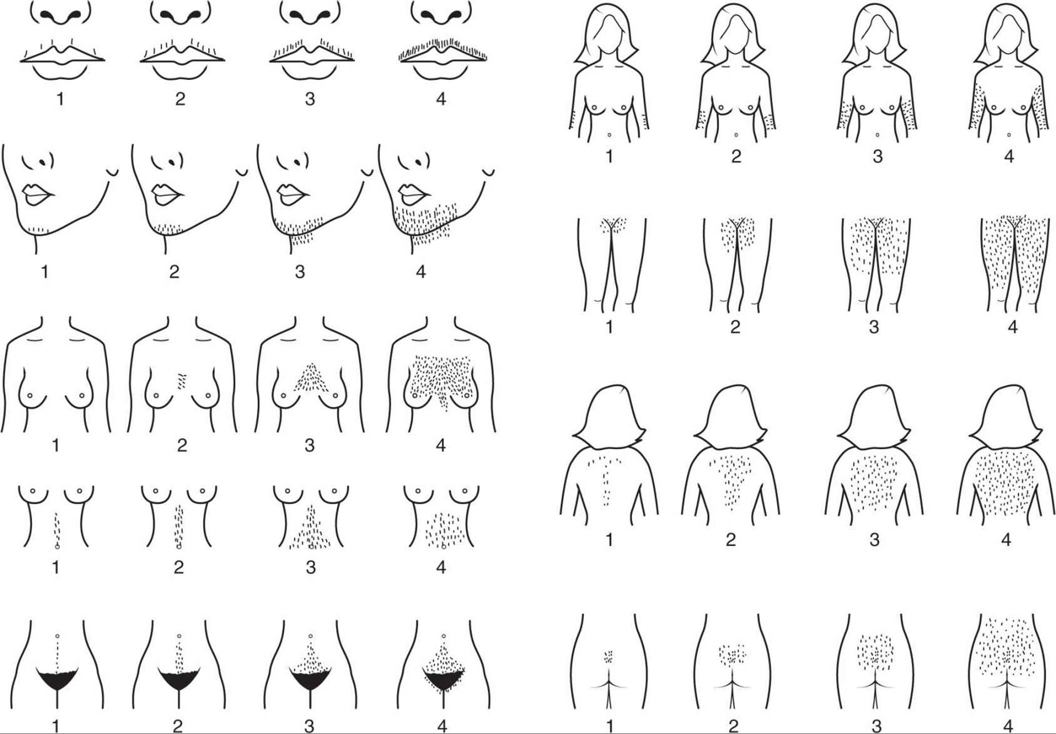 какие формы грудей бывают у женщин фото 25