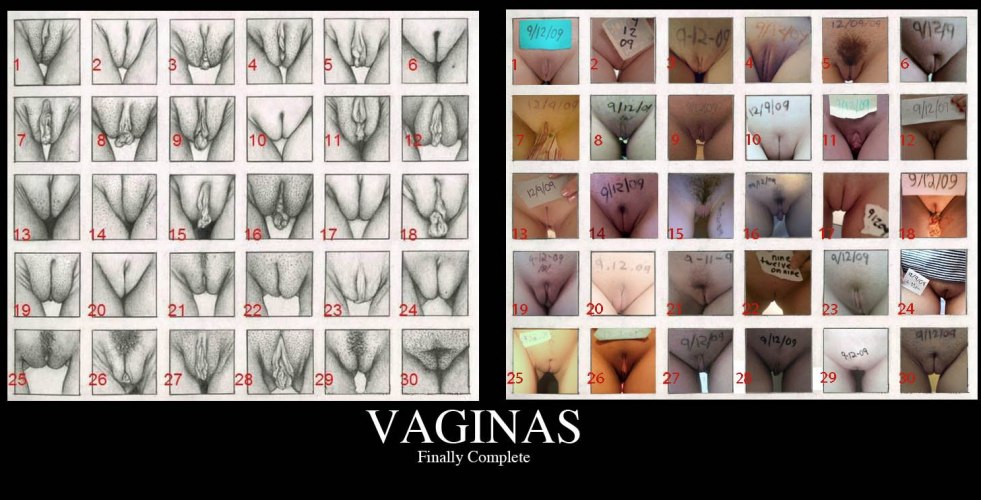 Vaginal shapes with names