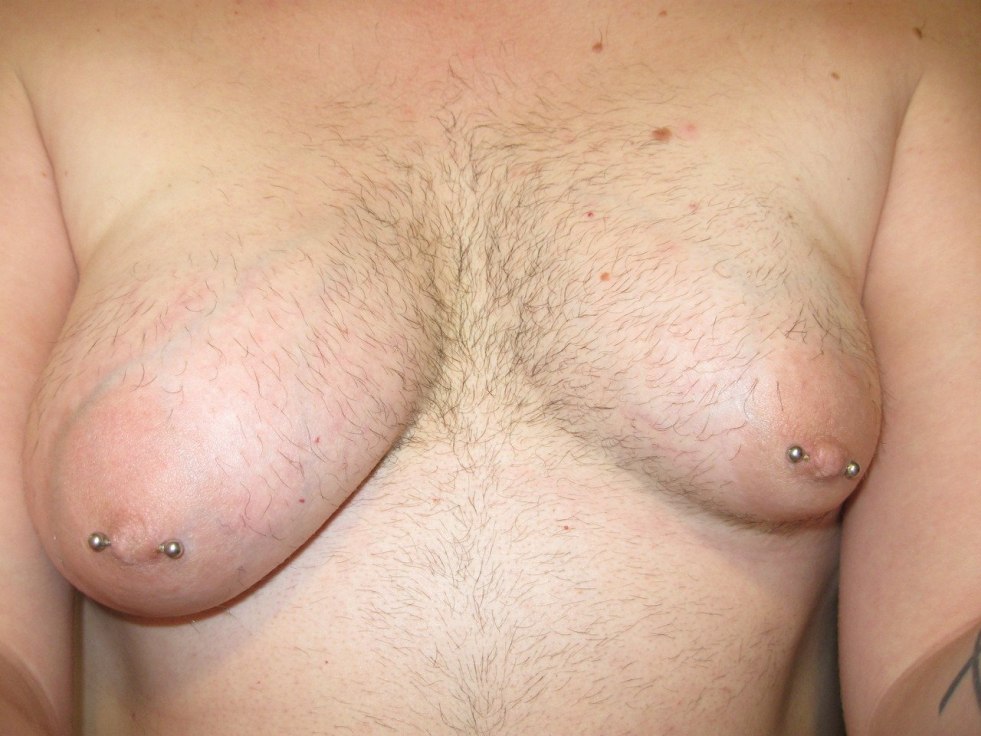 Hairy female breast naked