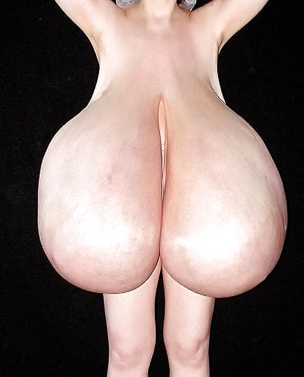 Makromastiya gigantomastia