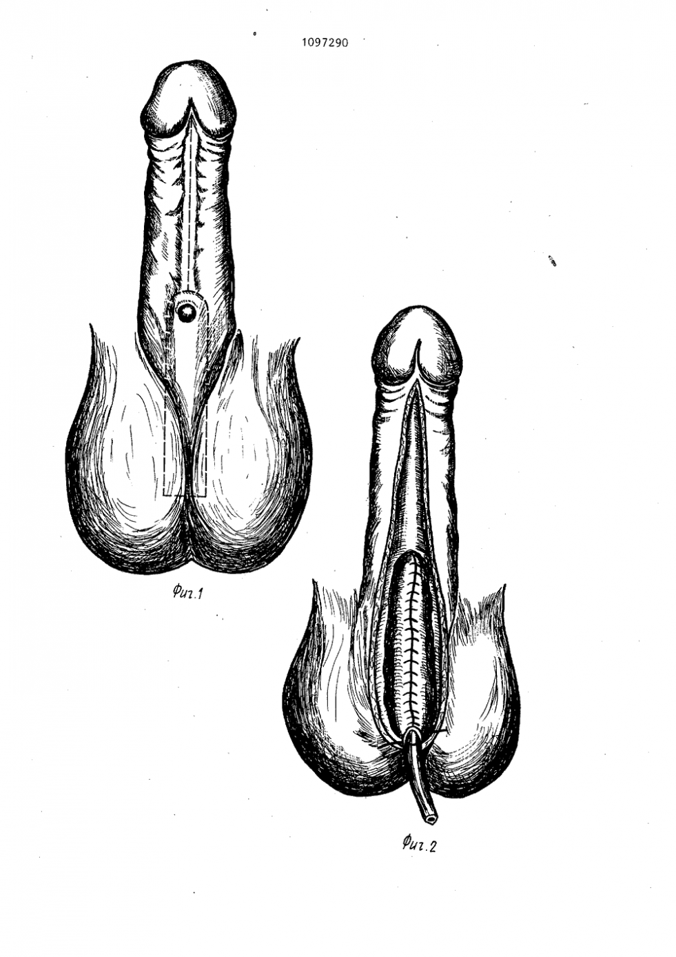 Semi-member close-up