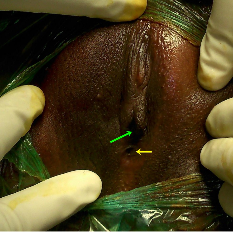 Cropped Vagina African