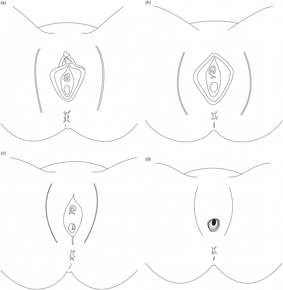 Making a cap of the clitoris