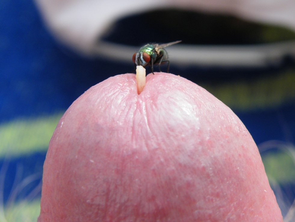 Flys on genitals