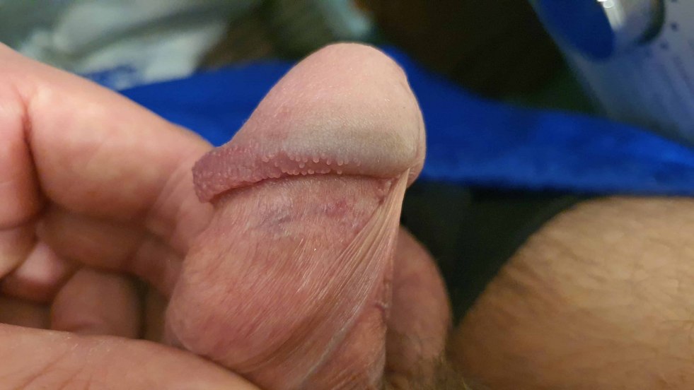 Male sexual member close-up