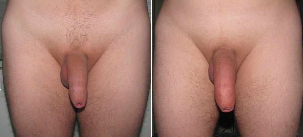 BDSM Young Benefyomy