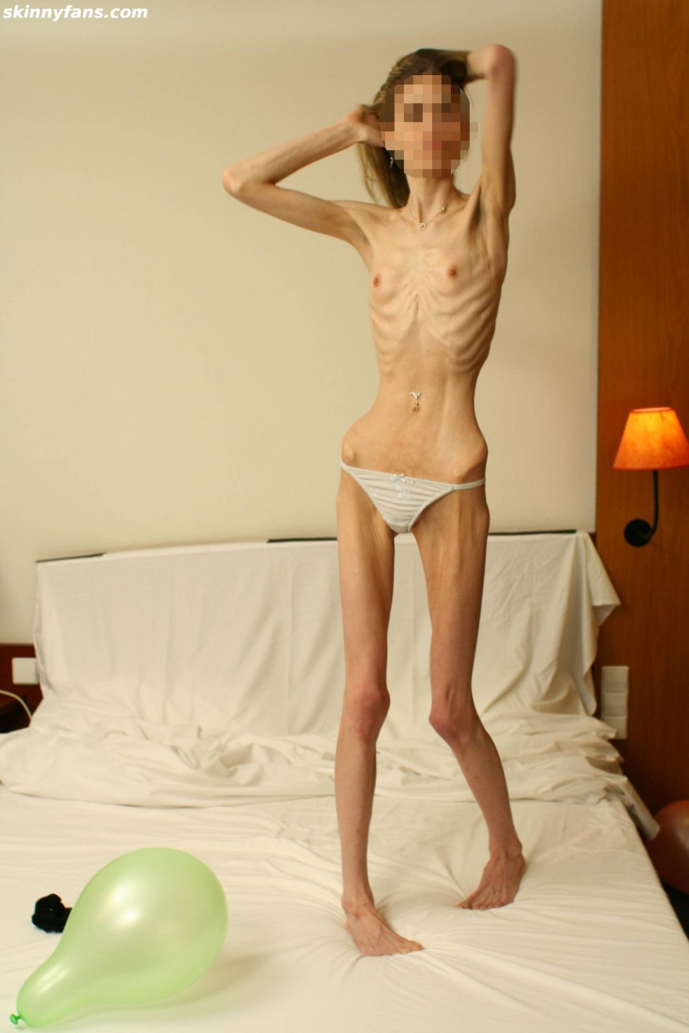 Naked guy with anorexia
