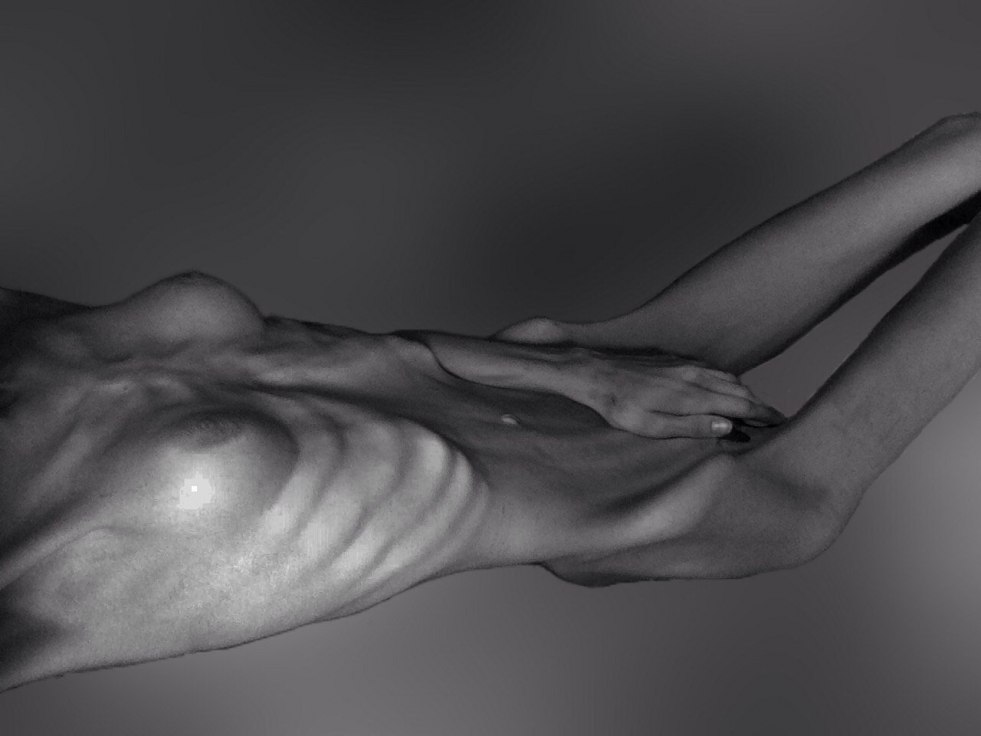 Naked anorexic girls
