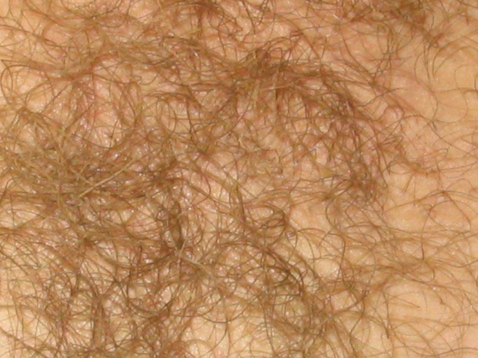 Young girls with hairy pussies
