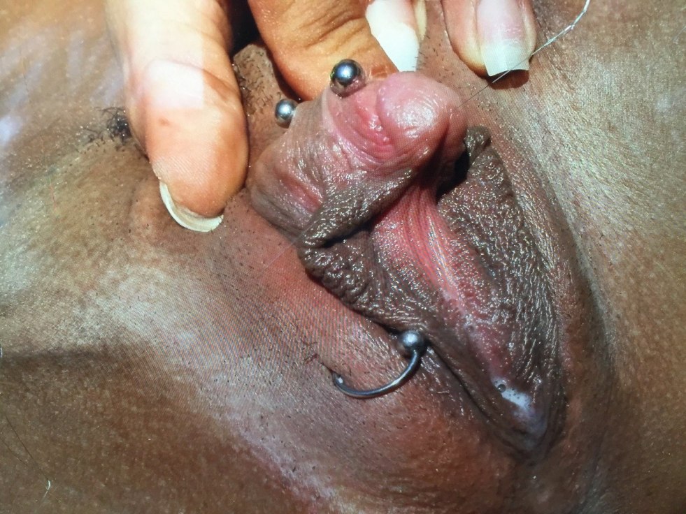 Huge head clitoris