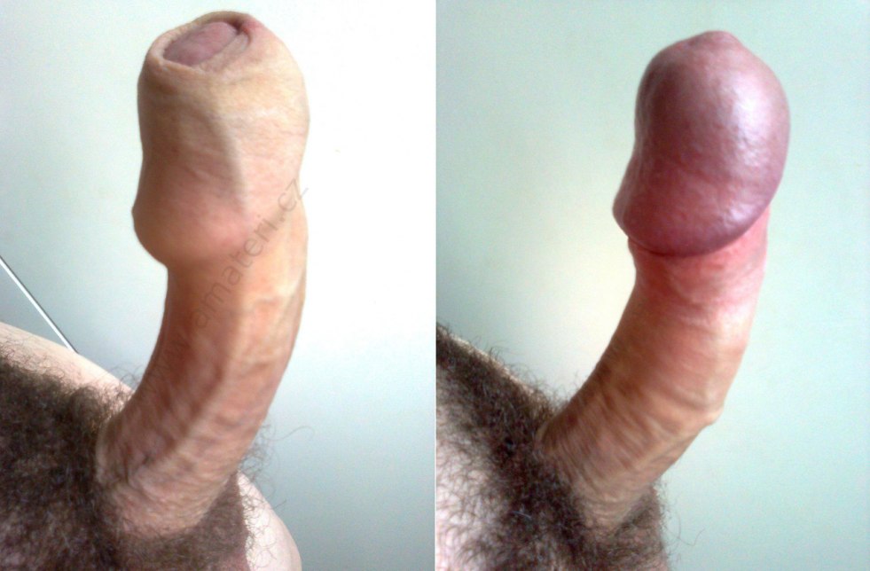Curved penis