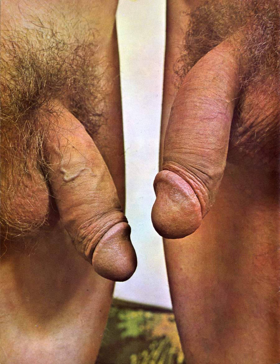 Male dick close -up