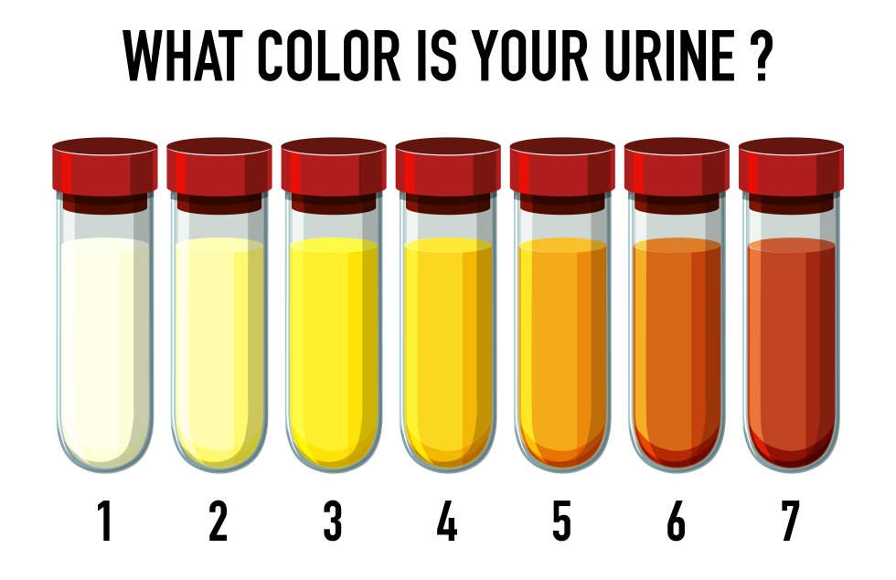 Coca urine color in trend
