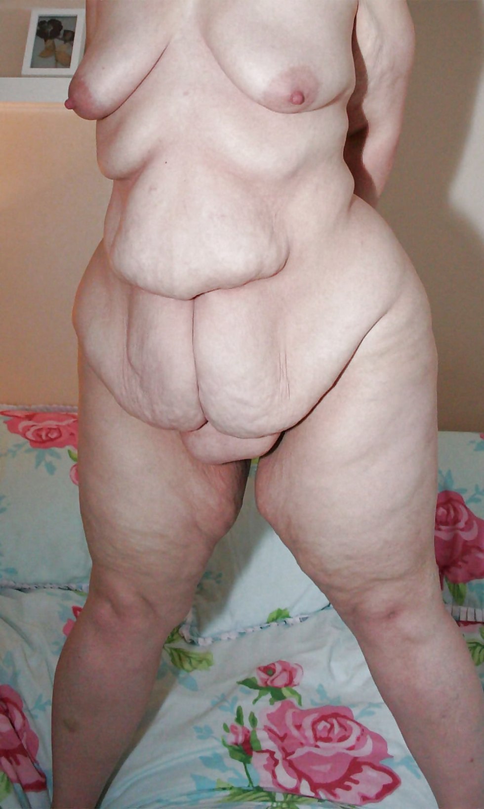 Naked cellulite hairy