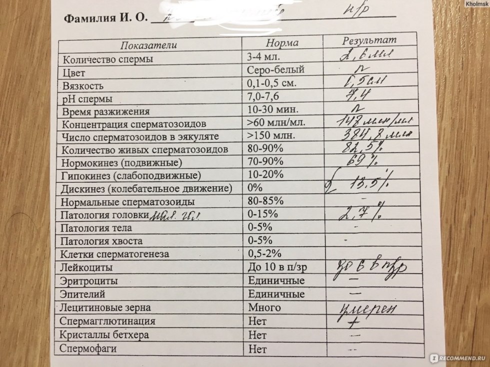 Lucifer and Dino Art