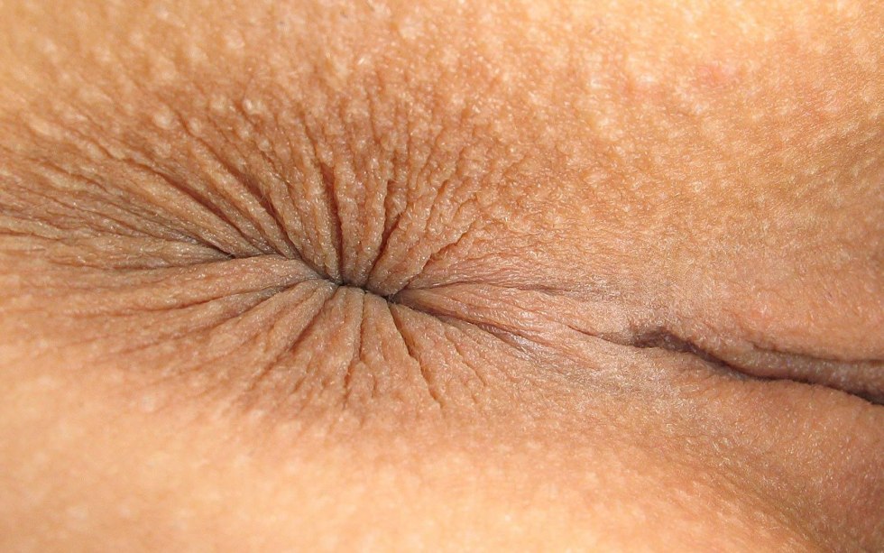 Anus backward view
