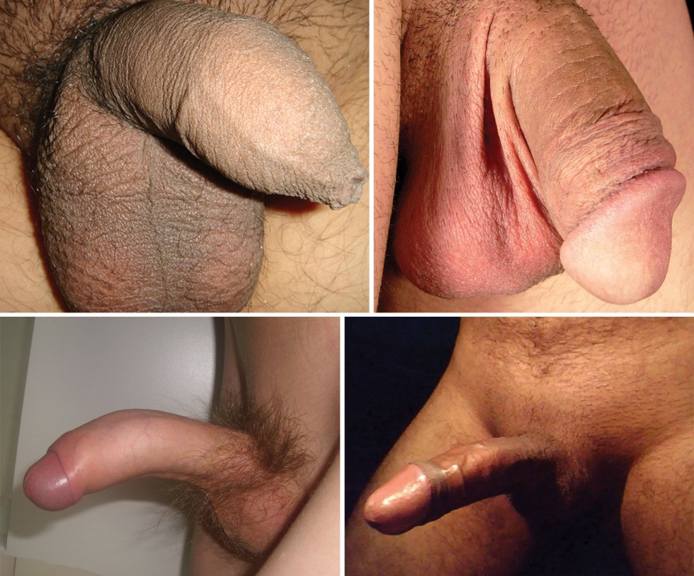 Male penis erection