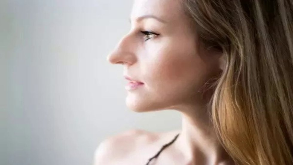 Roman nose with a hump