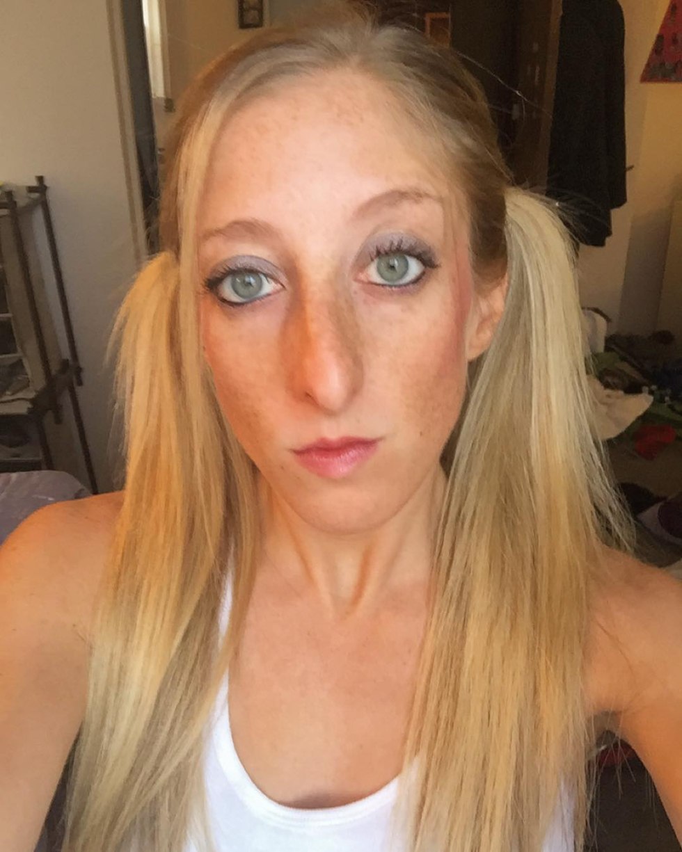 Nose with a hump by a Roman profile