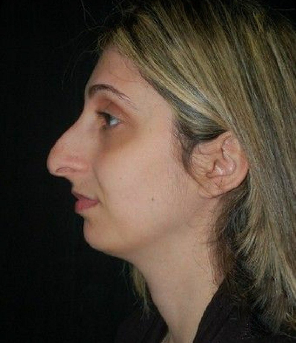 Open mouth of a girl amateur