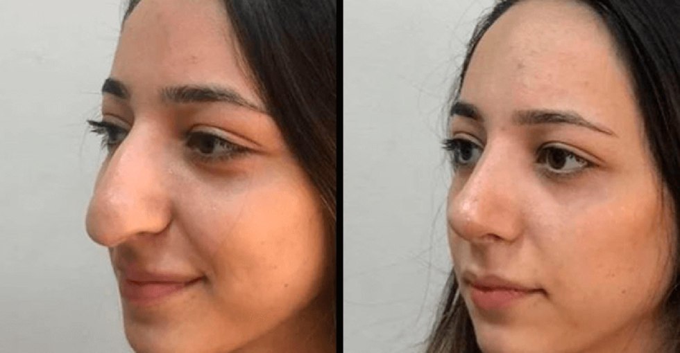 Feminine face close -up