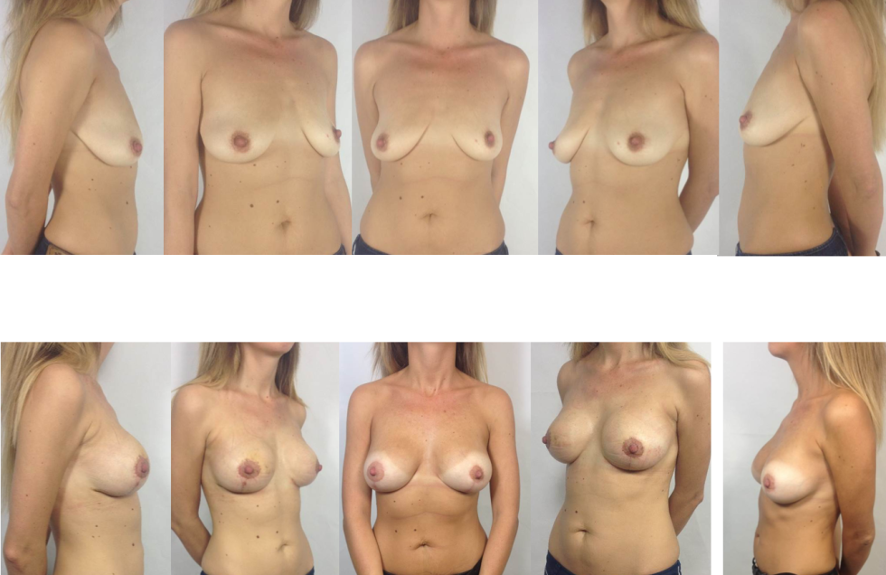 Women's boobs of different sizes