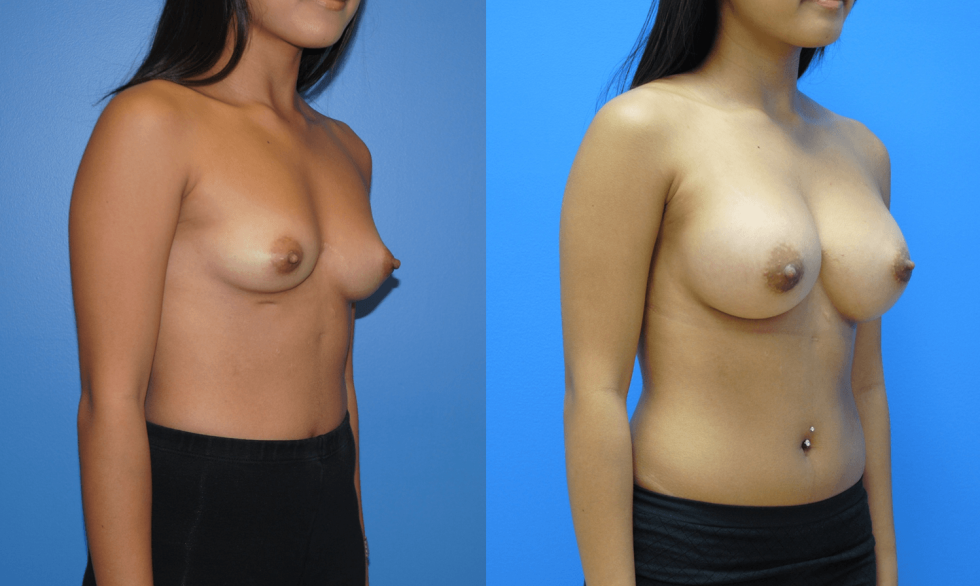 Naked female breasts on the side