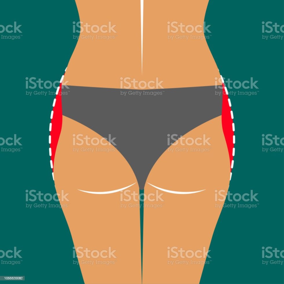 Daches Clio in Bikini