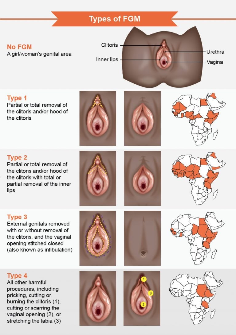 Varieties of women's vagina