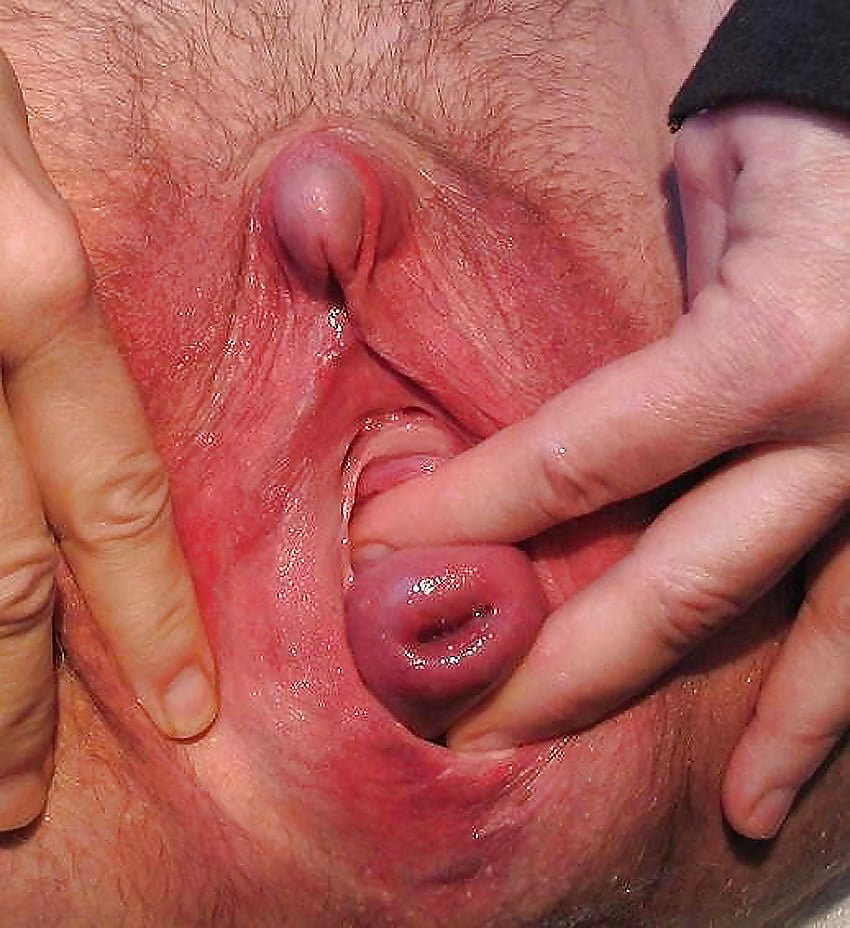 Fisting with large items