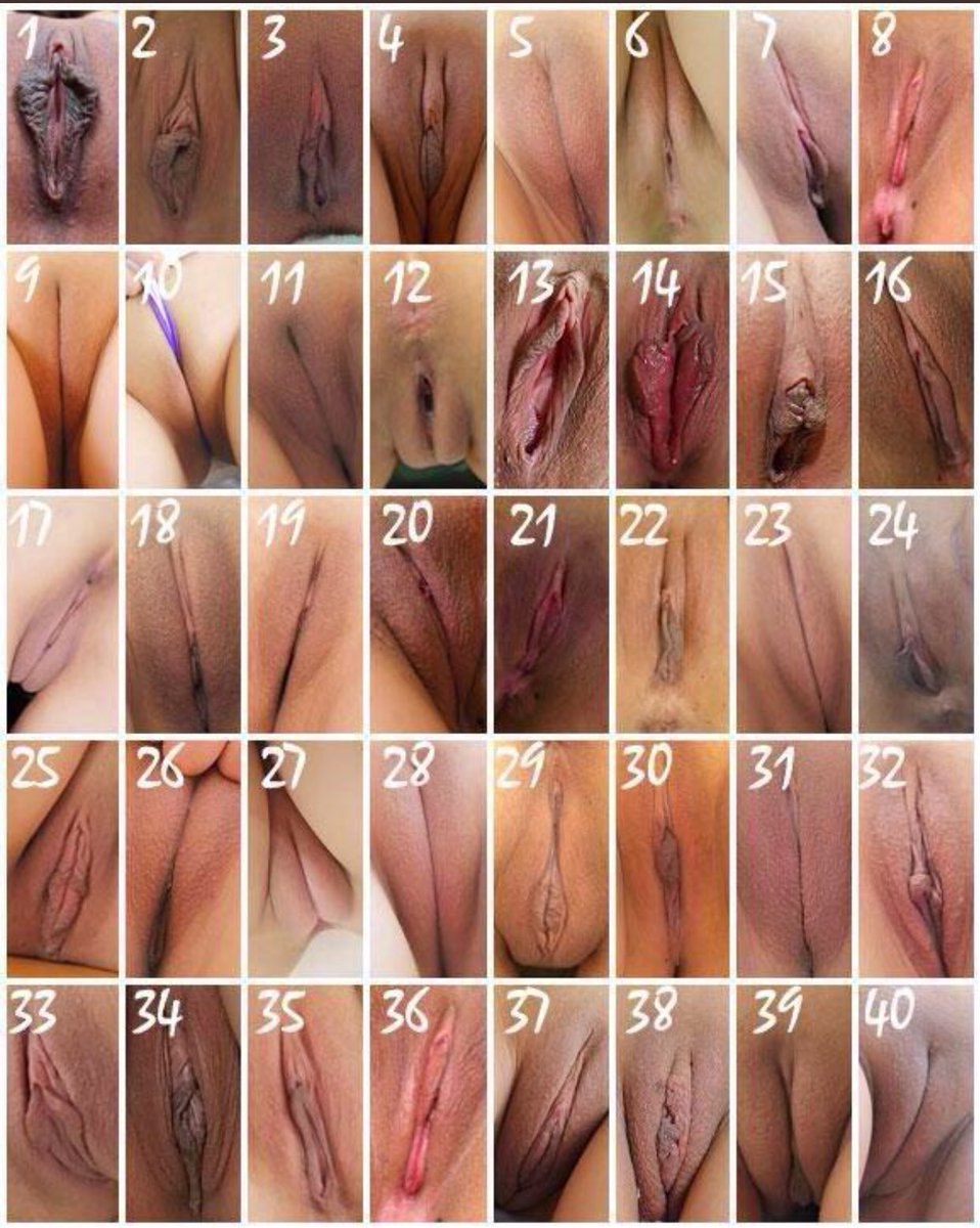 The location of the vagina