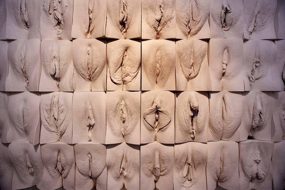 High location of the vagina